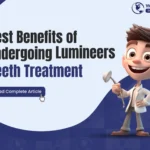 7 Best Benefits of Undergoing Lumineers Teeth Treatment