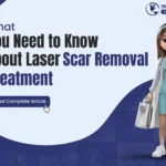 What You Need to Know About Laser Scar Removal Treatment